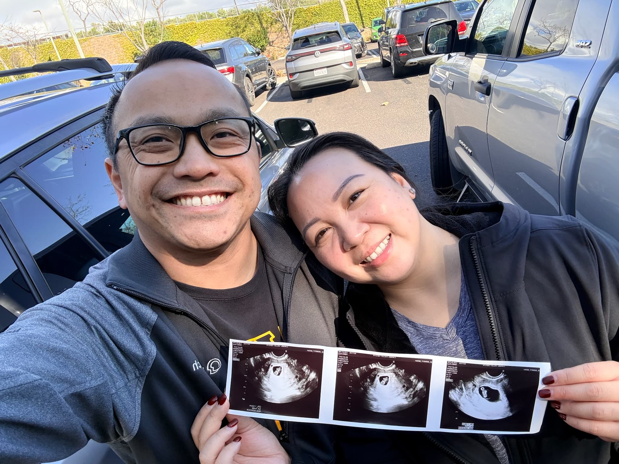 second ultrasound