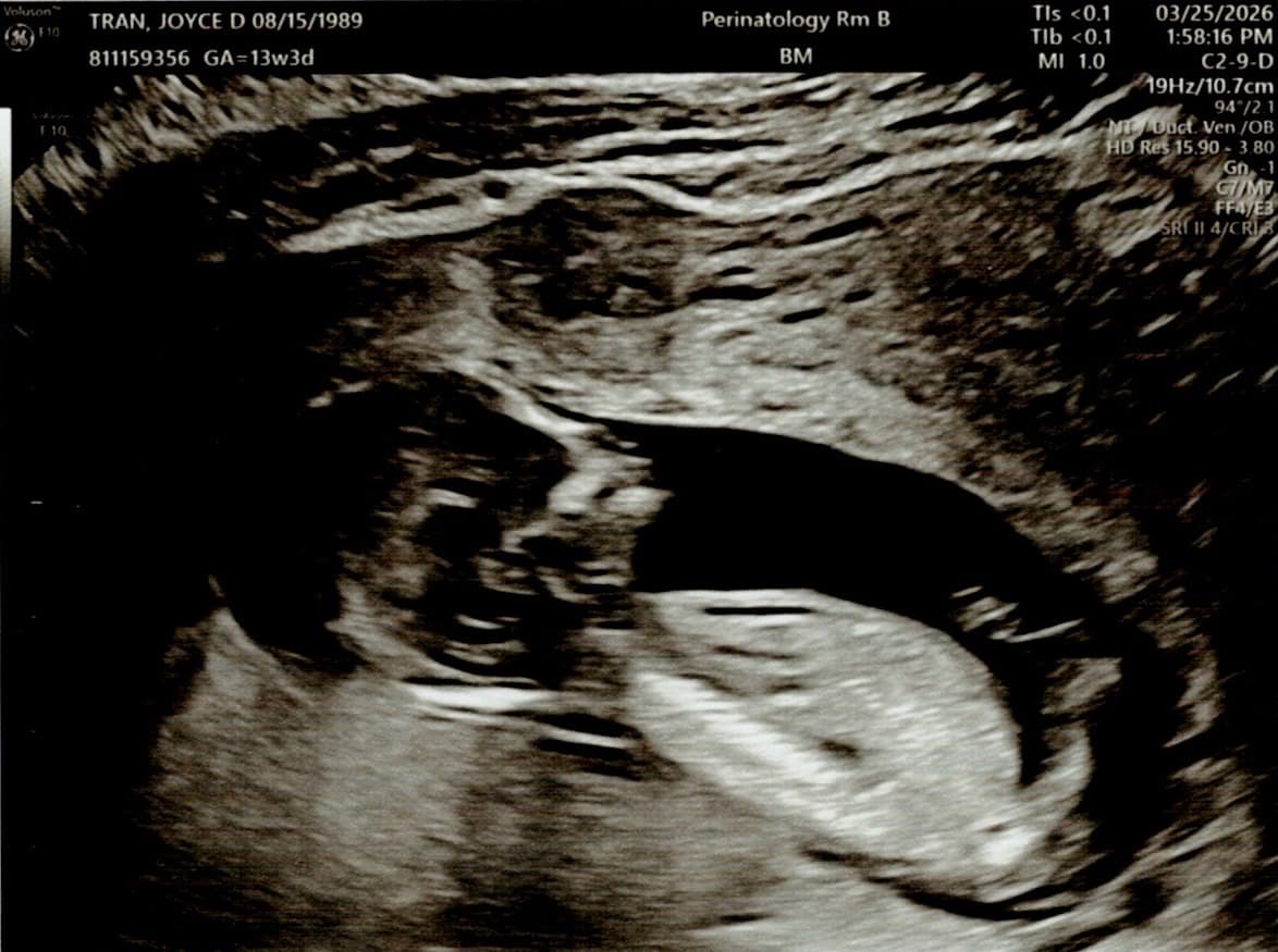 first ultrasound family photo